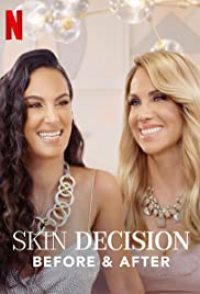 Skin Decision: Before and After streaming