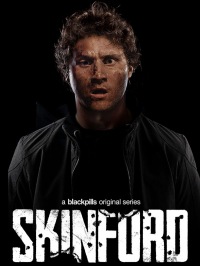 Skinford streaming Skinford streaming